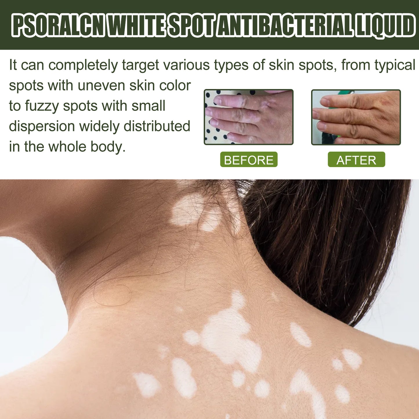 White Spot Purifying Serum – Whitening, Repairing & Moisturizing Serum for Spot Treatment