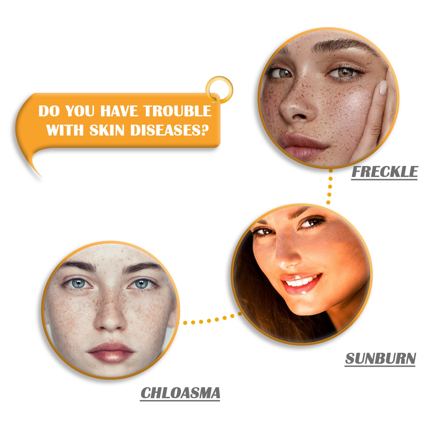 Xà phòng rửa mặt axit kojic, xà phòng làm sạch, xà phòng làm sạch nhẹ, sữa rửa mặt, xà phòng tẩy tế bào chết làm sạch lỗ chân lông, xà phòng chăm sóc da.