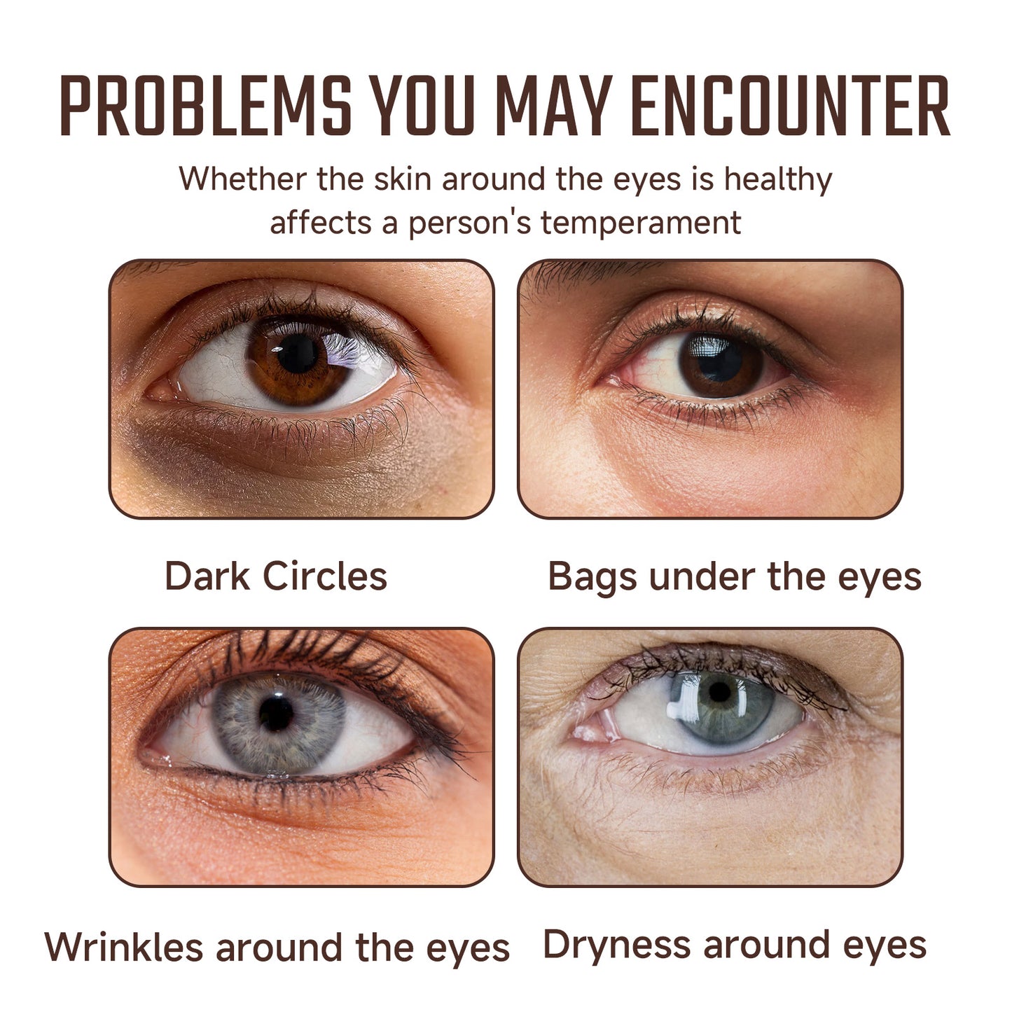 Eye Serum – Hydrating, Anti-Wrinkle & Brightening Eye Care