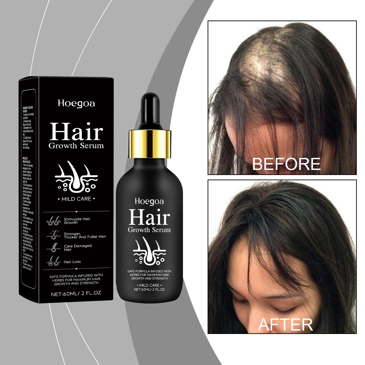 Hair Care Serum – Strengthens Hair & Nourishes Scalp with Daily Massage Treatment