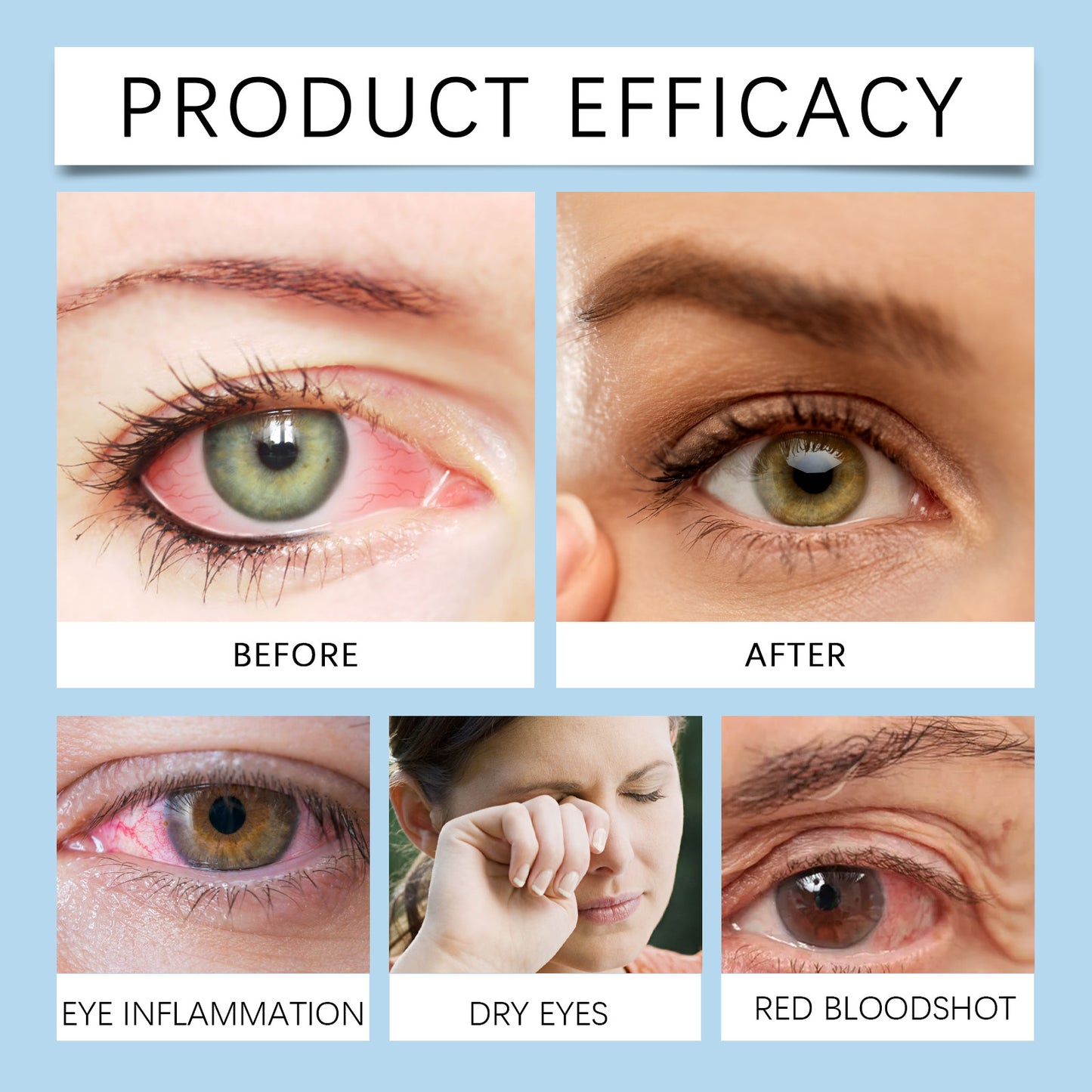 Eye Drops – Moisturizing Relief for Dryness, Soothing & Eye Health Care Solution