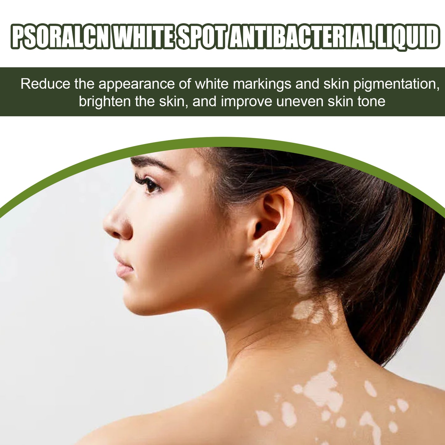 White Spot Purifying Serum – Whitening, Repairing & Moisturizing Serum for Spot Treatment